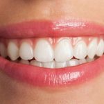 How to Get White Teeth: A Comprehensive Guide to Teeth Whitening Options