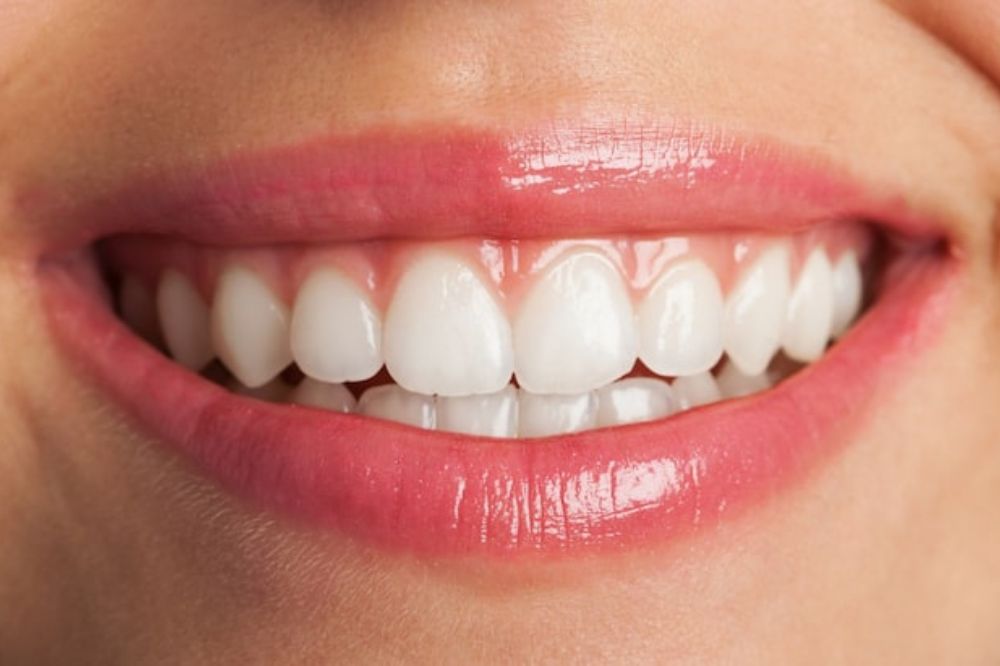 How to Get White Teeth: A Comprehensive Guide to Teeth Whitening Options