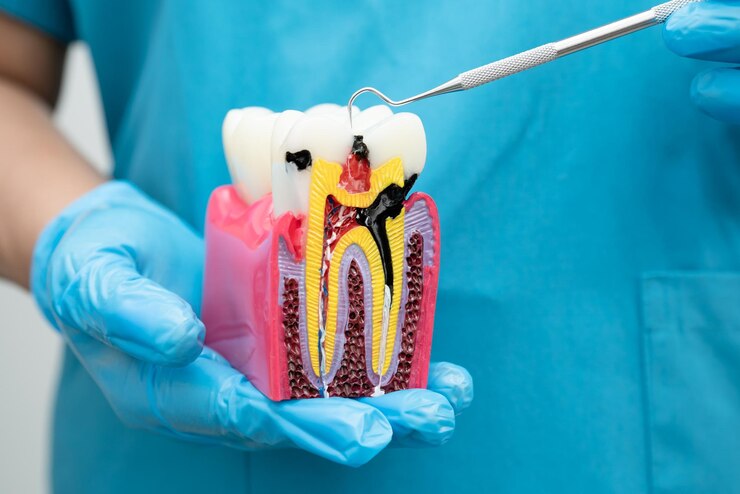 When is a Root Canal Necessary? Understanding the Signs