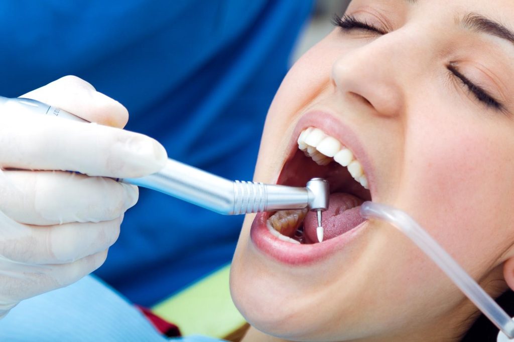 Dental Fillings: A Simple Way to Save Your Tooth