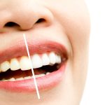 Why Do Teeth Stain Common Causes and Prevention Tips